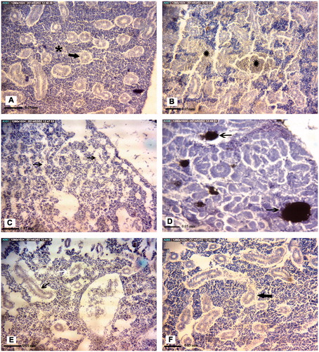 Figure 5. Representative photomicrographs of E. orientalis head kidney tissue structures. (A) Control site: Lymphoid tissue (black ), renal tubules (arrow). (B) Petrochemical Station: Hemorrhage (black ). (C) Majidieh Station: Empty spaces between cells (black arrows). (D) Ghazaleh Station: Melano-macrophage aggregations (black arrows). (E) Gaafari Station: vacuolation of renal tubular epithelial cells (black arrow). (F) Zangi Station: Lifting of tubular basement membrane (black arrow). All samples; H&E-stained, magnification = ×725).