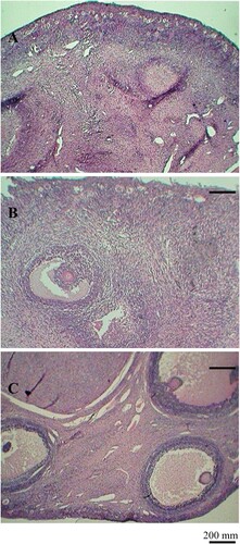Figure 1. Typical histological sections from the ovaries of goats fed different levels of dietary energy. From top to down, it represents ovaries from low-energy diet (A), medium-energy diet (B), and high-energy diet (C), respectively. Scale bars represent 200 µm.