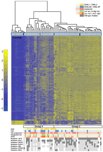 Figure 1. Hierarchical clustering according to DNA methylation in CMML distinguishes two main clusters. Heatmap showing the most variable (>0.4, P < 0.05) differentially methylated probes across the series of CMML patients. Each row represents a single probe and each column corresponds to a separate patient. Each probe has been normalized by the mean β-value in all samples and the color in the heatmap represents the scaled methylation value. Below is represented in color-code the distribution of the clinical features from the patients (WHO classification, FAB classification, AML progression, CPSS risk groups, and cytogenetic features and gene mutations). White gaps represent missing data. AML: acute myeloid leukemia; CPSS: CMML specific prognostic scoring system; FAB: French-American-British; Int: intermediate; WHO: World Health Organization.