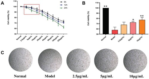 Figure 8. Protective effects of ACB on H2O2 induced PC12 cells. (A) Effects of various concentrations and treatment times of ACB on the viability of PC12 cells. (B) Effects of ACB (2.5, 5 and 10 μg/mL) on the viability of H2O2 induced PC12 cells. (C) The represented cell morphology of H2O2 induced PC12 cells with ACB (×100). *p < 0.05 and **p < 0.01 vs. model group.