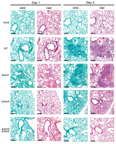 Figure 6 Histopathology of infected lung tissue. Mice were infected as described in Figure 5 and sacrificed on day 1 and 3 post-infection. The lungs were sectioned at 5 µm and stained with hematoxylin and eosin (H&E) or Grocott methenamine silver (GMS). Microscopic examinations were performed on a Zeiss Axioscope 2-plus microscope using Zeiss Axiovision version 4.4 software. Scale bar represents 100 µm.