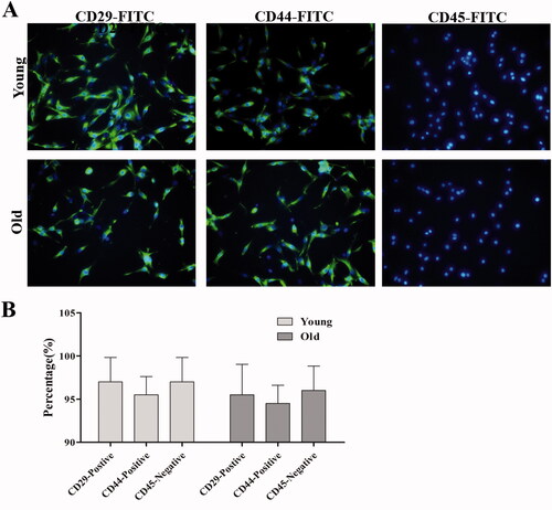 Figure 5. Immunofluorescence identification of the rBMSCs isolated from young and old rats. (A) Immunofluorescence was used to identify the purity of rBMSCs using a fluorescently labelled antibody. (B) The percentage of CD29-positive, CD44-positive and CD45-negative rBMSCs from young and old rats. Magnification ×400. Data are represented as the means ± SD (n = 5).