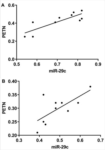 Figure 3. Correlation analysis between miR-29c and PTEN in rats with pneumonia. A) Correlation analysis of miR-29c and PTEN in serum of pneumonia rats; B) Correlation analysis of miR-29c and PTEN in lung tissue of pneumonia rats.