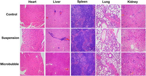 Figure 6 Representative histological H&E staining of heart, liver, spleen, lung and kidney tissues obtained from healthy mice at day 14 after intranasal administration of normal saline, sinalpultide suspension, and sinalpultide microbubbles at equivalent dose of 2.32 mg/kg per day (magnification: 400×).