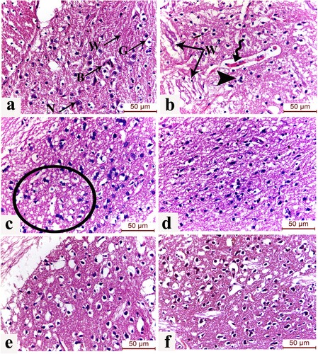 Figure 8. (a-f): Effect of laser and erythropoietin mesenchymal stem cell enhancement on L dopa-induced striatal histological changes. H&E-stained sections of the striatum (caudate/putamen) of (a) control group showing normal structure of striatum displayed as healthy neurons (N), blood capillaries (B), and pencil fibres of Wilson (W) unique to the striatum in addition to glial cells (G) with the classical fried-egg appearance. (b) Induced Parkinsonism group showing shrunken apoptotic neurons in a picture of astrogliosis and degenerated Wilson fibres (W). Blood vessels show mild congestion and widening of the perivascular (Virchow-Robin) spaces separating the vessel from the neuropil (spiral arrow) are also noticed. (c) L-dopa group showing degenerated neurons surrounded by glial cells (circle) (d) MSCs group showing moderate improvement of the striatal neuronal and neuropil architecture (f) EPO-activated MSCs group displaying preservation of the striatal structure with minimal nuclear pyknosis. (e) Laser-activated MSCs group showing the preserved structure of the neurons and glial cells. (H&E x400, scale bar 50 μm) (n = 8).