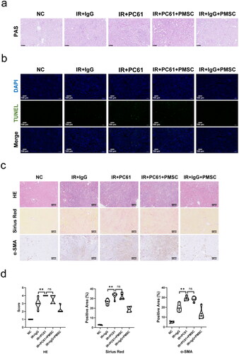 Figure 5. Tregs were exerted as a critical mediator during PMSC renoprotection. (a) The PAS staining was administrated to assess renal tubular injury on the day 2 after operation. Scale bars: 100 μm. (b) Immunofluorescence staining of TUNEL (green) and DAPI (blue) was administrated to assess renal tubular apoptosis on the day 2 after operation. Scale bars: 100 μm. (c, d) The HE, Sirius Red, and α-SMA staining were administrated to assess renal fibrosis on the 28th day after operation in the NC (n = 5), IR + IgG (n = 5), IR + PC61 (n = 5), IR + PC61 + BMSC (n = 5), and IR + IgG + PMSC (n = 5) groups. Scale bars: 250 μm. The Kruskal–Wallis one-way analysis of variance and post hoc tests with all pairwise were used to evaluate the differences. ns, p > .05; **p < .01.