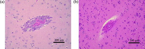 Figure 1.  Histological examination of tissues from (1a) wild terrestrial birds experimentally infected with H5N1 HPAI virus, A/mountain hawk-eagle/Kumamoto/1/07 and (1b) control birds given PBS. 1a: Perivascular inflammation with mononuclear cells was observed in brain sections of infected pale thrush sacrificed at 8 d.p.i. Haematoxylin and eosin stain. 1b: No inflammation was observed in brain sections of control pale thrush sacrificed at 8 d.p.i. Haematoxylin and eosin stain.