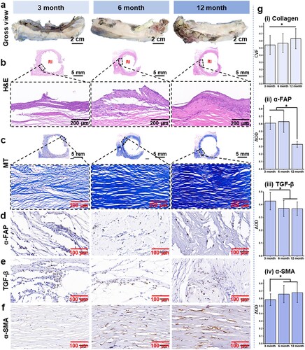 Figure 7. Gross views and histological examinations of the harvested PCL RI and its surrounding tissues. (a) Macroscopic observation of RIs with the surrounding tissues at 3-, 6-, and 12-month post-implantation. (b) H&E staining, (c) MT staining, (d) IHC staining for α-FAP, (e) TGF-β, and (f) α-SMA of the surrounding soft tissues at 3, 6, and 12 months after implantation. (g) IHC semiquantitative analyses of the surrounding soft tissues at 3, 6, and 12 months after surgery. (*p < 0.05).