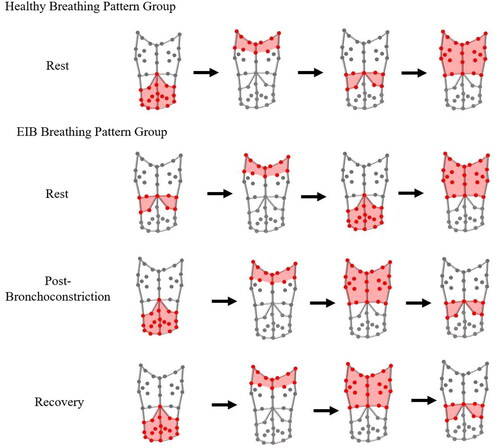 Figure 3. Illustration of the compartment movement order, from left to right, for the healthy asymptomatic breathing pattern group during rest, and exercise-induced bronchoconstriction breathing pattern group during rest, post-bronchoconstriction, and recovery post-exercise.