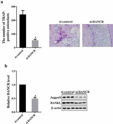 Figure 6. Knockdown of DANCR reduced root resorption in rat OTM model. Rats were divided into si-control and si-DANCR group. Each group had six rats. si-DANCR or si-control (1 nmol/time, 50 μl) was local injected into the buccal and lingual submucous between the first and second molars for three consecutive days. After seven days, PDL tissues of each rat were obtained for for TRAP staining, qRT-PCR and western blot. (a) The number of TRAP-positive osteoclasts. (b) The expressions of DANCR, Jagged1 and RANKL in PDL tissues. *P < 0.05 vs. si-control.