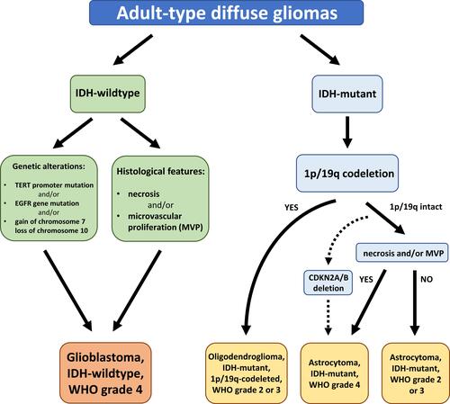 Figure 1 The 2021 WHO classification of the major diffuse gliomas in adults.