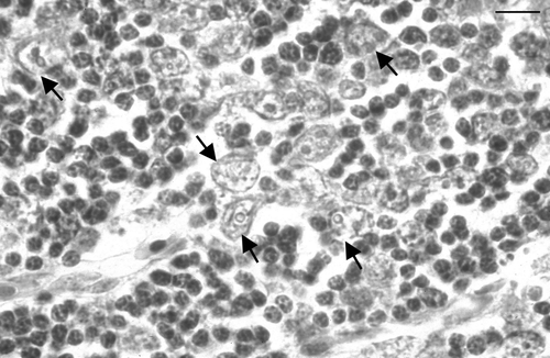 Figure 3.  Thymic cortex, day 13 p.i. There are numerous very enlarged nuclei (arrows) interspersed among normal sized lymphocytes. Several of the enlarged nuclei contain circular inclusions, the periphery of which stain eosinophilically. Bird inoculated when 3 weeks of age. Haematoxylin and eosin. Bar = 25 µm.