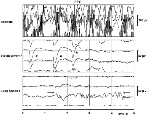 Figure 2. Normal EEG signals: chewing, eye movements and sleep spindles. Notes: s: seconds; µV: micro voltage; sleep spindles: →← and eye movements: *. Figure derived from horses is similar to humans.