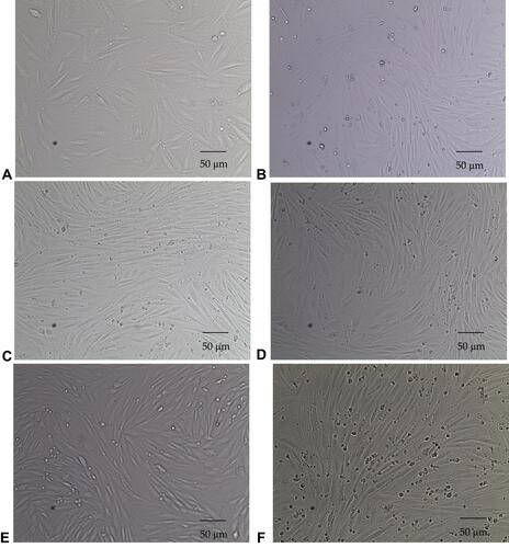 Figure 1 Images depicting L6 skeletal muscle myoblasts from rats, differentiated into L6 skeletal muscle myotubes (passage 7). (A) Myoblasts obtained on day 3 of the tissue culture in 10% FBS Ham F-10 media (10X). (B) Cells obtained on day 4 of the tissue culture in 6% horse serum Ham F-10 media (10X). (C) Myotubes obtained on day 5 of the tissue culture in 2% horse serum Ham F-10 media (10X). (D) Myotubes obtained after 4 hours of tissue culture in 2% delipidated serum Ham F-10 media (10X). (E) Myotubes obtained after one hour of cell starvation in only Ham F-10 media (10X). (F) Myotubes obtained after 19 hours of cell starvation in only Ham F-10 media (10X), (scale bar 50μm).