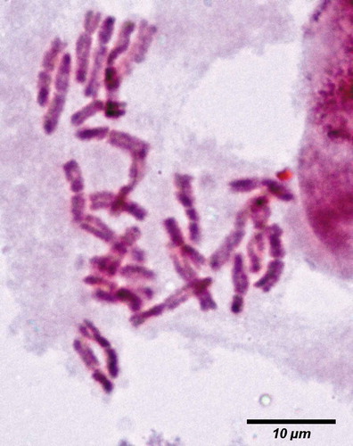 Figure 1. Elymus semicostatus, mitosis 2n = 28. Scale bar = 10 μm.