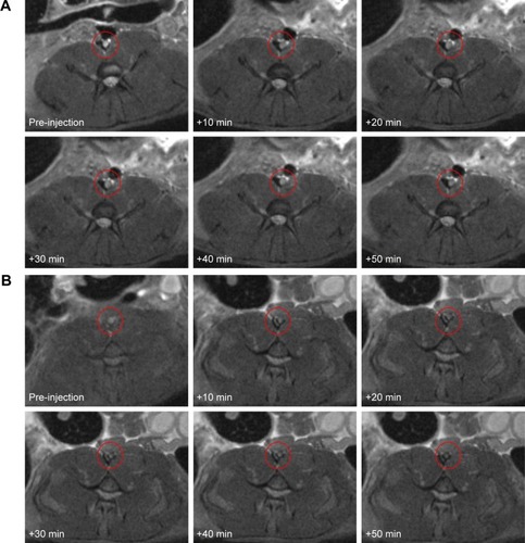Figure 9 Magnetic resonance imaging T2WI images of the in vivo thrombosis before and after the injection of NPs.Notes: (A) Fe3O4-PLGA NPs and (B) Fe3O4-PLGA-cRGD NPs. Ten minutes after injection, the hyperintense signal of the abdominal aorta began to decrease and the signal of the peripheral zones of the abdominal aorta first obviously decreased and then gradually increased until 50 min in the Fe3O4-PLGA-cRGD NP group. There was no significant decrease in the signal of the abdominal aorta before or after injection in the Fe3O4-PLGA NP group.Abbreviations: cRGD, cyclic Arg-Gly-Asp; NPs, nanoparticles; PLGA, poly(lactic-co-glycolic acid); T2WI, T2-weighted imaging.
