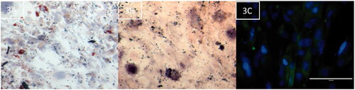 Figure 3. Immortalized ASC retain cell differentiation capacity to adipocytes, osteoblast, smooth muscle cells. (A) Immortalized ASC differentiated to adipocytes. (B) Differentiated to osteoblasts. (C) Differentiated to smooth muscle cells.