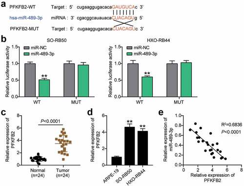 Figure 5. miR-489-3p targets PFKFB2 in RB cells. (a) Starbase V2.0 online database predicting the target molecule of miR-489-3p. (b) The effect of miR-489-3p mimic for dual luciferase reporter gene detection on the luciferase activity of wild-type and mutant PFKFB2. **P < 0.001, vs. miR-NC. (c) qRT-PCR was used to detect the expression of PFKFB2 in RB tissues (N = 24) and normal tissues (N = 24). (d) qRT-PCR detecting the expression of PFKFB2 in ARPE-19, SO-RB50 and HXO-RB44. **P < 0.001, vs. ARPE-19. (e) The correlation between the expression of miR-489-3p and PFKFB2 in RB tissues was evaluated by Pearson analysis. Data are presented as mean ± SD. N = 3, repetition = 3.