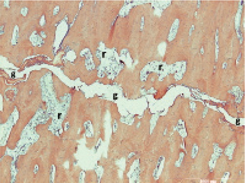 Figure 6. Resorptive cavities (r) with increased cellular activity and numerous osteoclasts in the bone adjacent to the fracture gap (g).