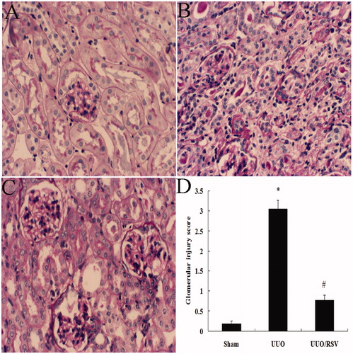Figure 1. Photomicrographs of glomeruli (A–C). Glomerular injury scores (D) were evaluated as described in “Materials and methods”. Compared with the sham group (A), the UUO group showed cell proliferation and sclerosis (B). Treatment with RSV markedly attenuated UUO-induced glomerular injury (C, D). *p < 0.01 versus the sham group; #p < 0.01, UUO versus UUO/RSV group. Magnification, ×400; PAS staining.