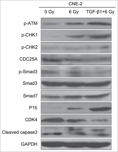 Figure 6. TGF-β1 activated the ATM pathway, increased the expression of Smad7 and inhibited the phosphorylation of Smad3.
