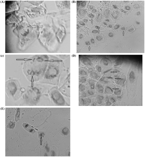 Figure 3. Some chromosomal anomalies induced by the fungicide Royal Flo in the meristematic roots to Zea mays L.: anaphase bridge (A); binucleated cells (B); cell with ring chromosomes and fragments (C); sticky chromosomes in metaphase (D); cell with micronucleus (E).