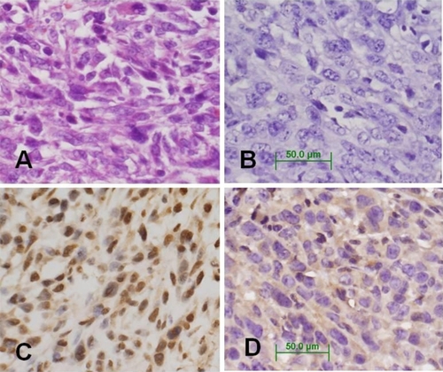 Figure 3 Immunohistochemical analysis of PR and mPRα protein expression in 4T1 tumor tissues. A) 4T1 tumor stained with H & E. B) Negative control of 4T1 tumor tissue stained without primary antibody. Magnification of all images is 400×. C) 4T1 tumor tissue stained with anti-PR. D) 4T1 tumor tissue stained with anti-mPRα.Abbreviations: H & E, hematoxylin & eosin; PR, progesterone receptor; 4TI, mouse mammary cell line.