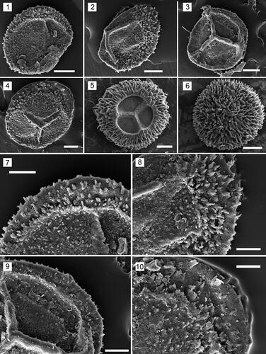 Plate 1. Images of megaspores of Biharisporites Potonié. All photomicrographs taken with a scanning electron microscope. 1–4, 7–10. Megaspores from the Lower Permian of the Rajmahal Basin, India. 5, 6. Megaspores from the Upper Givetian of the Kursk Region, Russia. 1. Biharisporites cf. spinosus, specimen 409-1, proximal face; the ultrastructure is shown in Plate 3 (figures 1–4), Supplementary Plate S3 (figures 1–3). 2. Biharisporites boralii Bajpai, specimen 409-2, proximal-equatorial view; the ultrastructure is shown in Plate 4 (figures 1–4), Supplementary Plate S4 (figures 1–4). 3. Biharisporites sp. 1, specimen 409-3, proximal face; the ultrastructure is shown in Plate 5 (figures 1–6), Supplementary Plate S5 (figures 1–3). 4. Biharisporites sp. 2, specimen 409-4, proximal face; the ultrastructure is shown in Plate 6 (figures 1–3), Supplementary Plate S5 (figures 4, 5). 5. Biharisporites arcticus var. productus Chi & Hills 1976, specimen 410-03, proximal face; the ultrastructure is shown in Plate 2 (figures 1–5), Supplementary Plate S1 (figures 1–5), and Supplementary Plate S2 (figures 1, 2). 6. Biharisporites arcticus var. productus Chi & Hills, specimen 410-04, distal face. 7. Biharisporites cf. spinosus, enlargement of figure 1 showing the surface of the spore. 8. Biharisporites boralii, enlargement of figure 2 showing the surface of the spore. 9. Biharisporites sp. 1, enlargement of figure 3 showing the surface of the spore. 10. Biharisporites sp. 2, enlargement of figure 4 showing the surface of the spore. Scale bar: 1–6 = 100 µm; 7–10 = 50 µm.