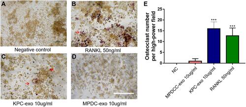 Figure 3 The differentiation of RAW264.7 cells to osteoclast was enhanced when culturing with KPC-exosome, compared with MPDC-exosomes. (A–D) Culture in conditioned medium from KPC-exo 10ug/mL promoted the osteoclast differentiation, where MPDC-exosomes did not work and RANKL as positive control, scale bar, 200 μm. (E) The number of osteoclasts induced by KPC-exo significantly increased ***P < 0.01.