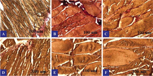Figure 3. Longitudinal sections of muscles from six portions of farmed common carp (Cyprinus carpio) viewed by light microscope. Scale bars: 100 μm; A: upper back, B: lower back, C: tail, D: jaw, E: chest, and F: belly.