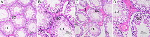 Figure 3 Effect of LPS-induced systemic inflammation on testis histology between LPS group and control group. (A) Control group (×100), (B) Control group (×200), (C) LPS group (×100), (D) LPS group (×200) In the LPS group, there was a clear edema between the seminiferous tubules, the order of the seminiferous lineage was disappeared in the lumen, and the number of germ cells and sperm was decreased.