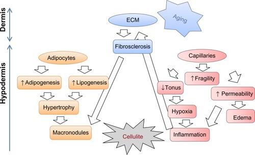 Figure 1 Major mechanisms involved in cellulite. The exact etiology of cellulite is still a matter of debate but most scientists agree on the involvement of reduced microcirculation, interstitial liquid infiltration (edema), localized hypertrophy of adipocytes, oxidative stress, and persistent low grade inflammation, combined with ECM alterations. Cellulite and skin aging may influence each other.