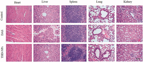 Figure 11. H&E staining of the heart, liver, spleen, lung, and kidney after free DAS and THD-NPs treatment versus control. Histological sections of heart, liver, spleen, lung, and kidney from the nude mice were stained with hematoxylin and counter-stained with eosin and microscopically analyzed for histopathological examinations of tissue toxicity. The images were taken at 400× objective lenses. Scale bar = 50 μm.