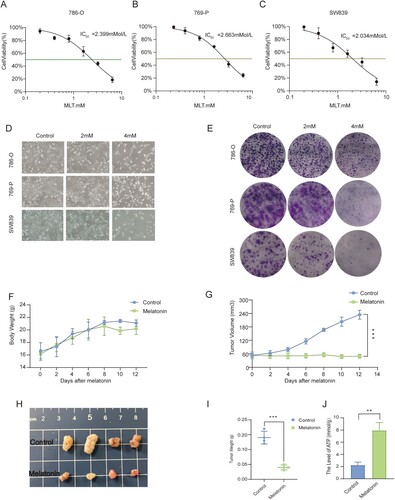 Figure 1. MLT Significantly inhibited the proliferation of RCC In vivo and in vitro. (A, B, C) Relative cell viability of 786-O, 769-P and SW839 cells treated with MLT at different concentrations for 24 h was measured by MTT assays. (D) 786-O, 769-P and SW839 cells treated with MLT at different concentrations for 24 h. Cells were stained with trypan blue, and the number of the cells is shown for different group. (E) Colony formation test of RCC cells after treated with MLT. (F) The nude mouse body weight was measured every 2 days with/without MLT treatment. (G) The nude mouse tumor volume was measured every 2 days with/without MLT treatment. (H) After sacrificing, tumors were isolated and photographed after treatment with/without MLT for 12 days. (I) After sacrificing, tumors were isolated and weighted after treatment with/without MLT for 12 days. (J) The level of ATP in mouse tumors was measured (n = 3, mean ± SD).