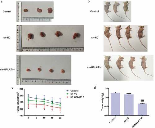 Figure 9. LncRNA MALAT1 interference inhibits tumor growth. (a) The phenotypes of tumors in vitro. (b) The phenotypes of tumors in vivo. (c) The tumor growth curve according to tumor volume. *P < 0.05 vs. control group. (d) The tumor growth curve according to tumor weight. ***P < 0.001 vs. control group. ###P < 0.001 vs. sh-NC group