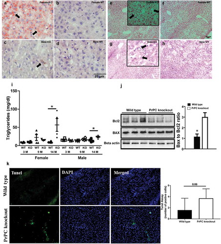 Figure 1. Lipid levels in PrPC knockout mice: Liver tissue stained with Sudan III (a-d), H and E stain (e-h) shows a higher fat deposition in the liver of 14 months female PrPC knockout mice (a and e) as compared to the wild type mice (b and f). Biochemical analysis shows a higher triglyceride concentration in 14 months PrPC knockout mice as compared to the wild type controls (i). Comparatively, the fat content in the liver of male PrPC knockout mice (c and g) was lower than the female group. Nuclei were stained with hematoxylin. Western Blot analysis showed a significant down-regulation of Bcl2 expression in the liver of PrPC knockout mice as compared to the wild type mice (j), while the expression of Bax was up-regulated in PrPC knockout liver with a net increase of Bax to Bcl2 ratio. (k) TUNEL assay in the 14-month-old PrPC knockout mice liver and WT controls. (3-month-old – 3 M, 9-month-old – 9 M, 14-month-old – 14 M)
