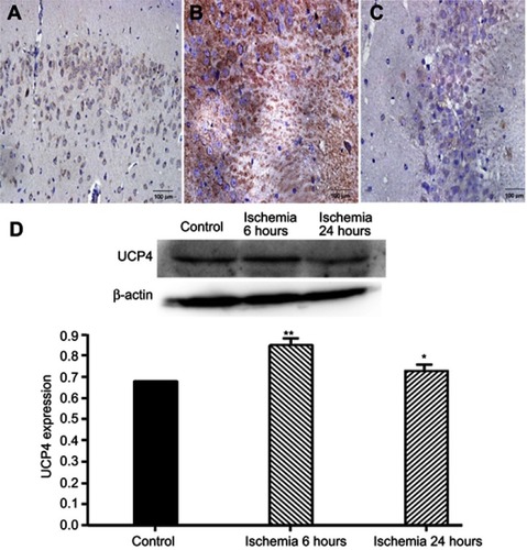 Figure 2 Expression of uncoupling protein 4 (UCP4) at different stages of cerebral ischemia/reperfusion. (A) Control group (the cortex, ×20); (B) ischemia 6 hours (the hippocampus, ×20); (C)  ischemia 24 hours (the hippocampus, ×20). (D) Western blot analysis of UCP4 expression. *P<0.05 vs control group, **P<0.01 vs control group, n=3.