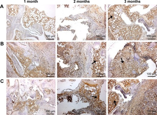 Figure 9 Immunohistological staining of type I collagen after GL (A), 15nDGC (B) and 30nDGC (C) scaffolds implanted into femoral defects of rabbits for 1, 2 and 3 months.Notes: Arrows represent type I collagen expression. The magnification is ×100.Abbreviation: GL, gliadin.