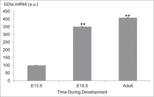 Figure 9. GDIα mRNA expression in podocytes is increased during kidney development. FlexArray analysis of microarray data in podocytes isolated from developing mouse kidneys at embryonic day (E) 13.5, 15.5 and adult kidneys showed that GDIα mRNA increases during development (n = 3 for each stage). *p < 0.01.