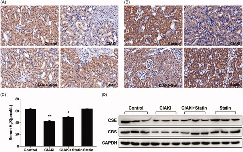 Figure 7. Atorvastatin restores H2S generation in rat CIAKI model. Serum H2S level was detected by ELISA kit (C). Two key enzymes of H2S generation in kidney, CSE and CBS, were quantified by Western blot analysis (D) and immunohistochemical staining (A for CSE, B for CBS). As shown, rats in CIAKI group had considerably lower serum H2S level, as well as deterioration of renal CSE and CBS expression. Atorvastatin could restore the systemic H2S expression and renal expression of CSE and CBS. Data are presented as mean ± SD (n = 6). **p < 0.01 versus control group. # p < 0.05 versus CIAKI group.