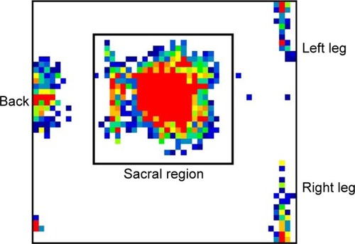 Figure 3 Representative view of the pressure distribution at the surface of the sacral region with the participant in the lithotomy position.