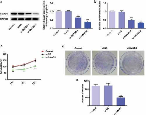 Figure 8. SMAD5 silencing inhibited AGS cell proliferation. (a) The proteins expression of SMAD5 was determined by western blot. (b) The mRNA level of SMAD5 was quantified by RT-qPCR. (c) The viability of AGS cells transfected with or without si-SMAD5 was evaluated with cell viability assay. (d) The cell proliferation was assessed by colony formation assay, and quantification (e). Error bars represent the mean ± SEM from three independent experiments. ***P< 0.001 vs. Control