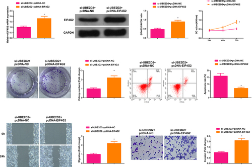 Figure 6. Circ-UBE2D2 facilitates the progression of NSCLC via modulating miR-376a-3p/EIF4G2 axis.