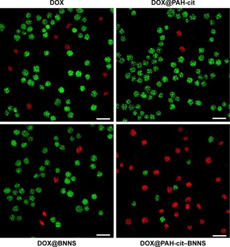 Figure 8 Live/dead images of HeLa cells incubated with free DOX, DOX@PAH-cit, DOX@BNNS, and DOX@PAH-cit–BNNS complexes (live cells are represented in green and dead cells in red). Scale bars denote 50 µm.Abbreviations: BNNS, boron nitride nanospheres; DOX, doxorubicin; PAH-cit, poly(allylamine hydrochlorid)-citraconic anhydride.