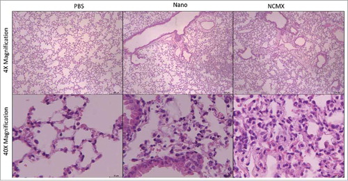 Figure 6. Evaluation of lung injury or tissue changes in intranasally vaccinated mice. Mice were vaccinated 2 times at 21-day intervals with NCMX. At 21 days after the last immunization, the lungs were collected, stained with H&E and analyzed for damage at 4x magnification (upper) and 40x magnification (botton).