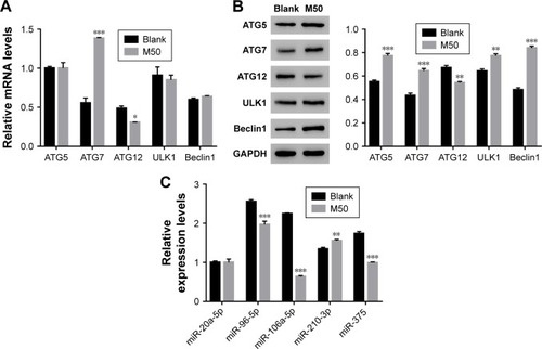 Figure 2 High level of melatonin affected the level of autophagy-related proteins and microRNAs in AF cells of patients with DD. (A and B) Show the mRNA and protein levels of ATG5, ATG7, ATG12, ULK1, and Beclin 1 in AF cells of patients with DD and treated with melatonin of 50 µmol/L. (C) The mRNA levels of miR-20a-5p, miR-96-5p, miR-106a-5p, miR-210-3p, and miR-375 in AF cells of patients with DD and treated with melatonin of 50 µmol/L.