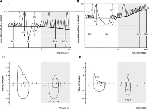 Figure 1 Lung volumes and capacities at rest and during exercise.