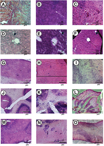 Figure 1. Histopathological features of effects of Amphotericin B administration in vivo. (A–O) Three groups of mice were used including, a negative control group; an intravenous group (injected with 4 mg/kg of Amphotericin B deoxycholate, referred to as iv.); and an intranasal group (2 mg/kg) + iv. group (2 mg/kg, referred to as IN group). Note that A (negative control), and C (IN group) show that glomeruli are devoid of ischemia and integrity of renal tubules remain unscathed with no signs of necrosis, while group B (iv.) exhibited tubular necrosis (white arrow). The sagittal sections of a liver lobular unit from caudate lobes are shown for (D) negative control; (E) iv. group; (F) IN group. Note that the architecture of the liver lobular unit is normal for D (negative control), and F (IN group), whereas the hepatocyte shredded into the hepatic central vein in group E (iv. group) mice (black arrow) and the intrahepatic duct was distorted with malalignment of hepatic acinus (black arrowhead). The tissues were stained in haematoxylin-eosin and were visualized under an inverted microscope (x400). (G–O) Shows different regions of the brain. For the olfactory bulb, (G) negative control; (H) iv. group; and (I) IN group. For the cerebellum, (J) negative control; (K) iv. group (L) IN group. For regions of pons – midbrain (M) negative control; (N) iv. group; (O) IN group.