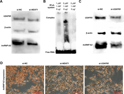 Figure 7 Knocking down NEAT1 and U2AF65 downregulated hnRNP A2 expression.