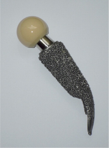 Figure 1. The CUT femoral neck prosthesis. Note the RSA marker at the distal tip of the prosthesis.